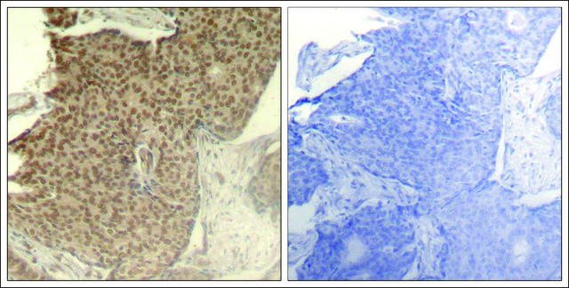 Anti-phospho-HDAC2 (pSer³??) antibody produced in