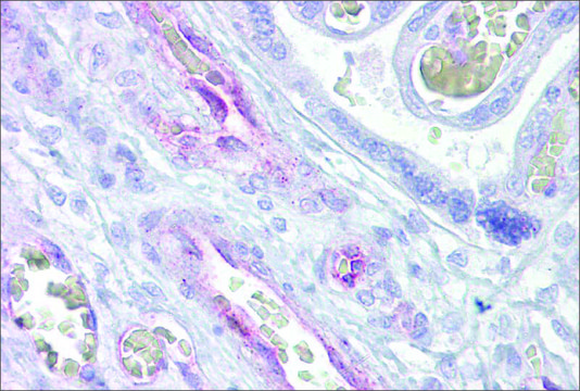 Anti-ARNTL2 antibody produced in rabbit