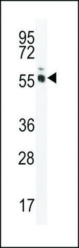 ANTI-MAGEL2(C-TERMINAL) antibody produced in rabbit
