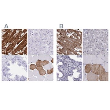 Anti-TNNC1 antibody produced in rabbit