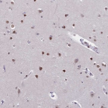 Anti-CBX7 antibody produced in rabbit
