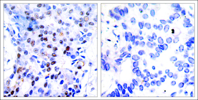 Anti-JUN (Ab-91) antibody produced in