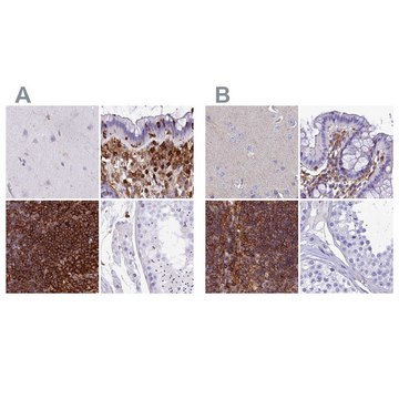 Anti-PPP1R18 antibody produced in rabbit