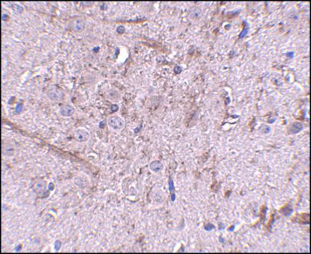 Anti-TOM70 antibody produced in rabbit