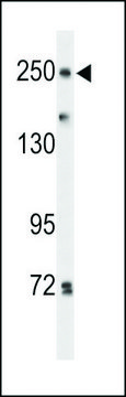 ANTI-PTPRD(N-TERMINAL) antibody produced in rabbit