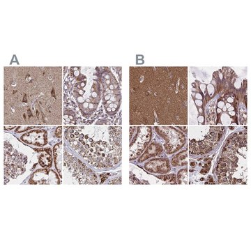 Anti-NFS1 antibody produced in rabbit