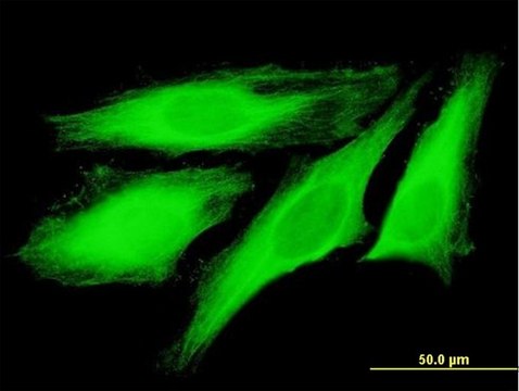Anti-TUBB4Q antibody produced in mouse