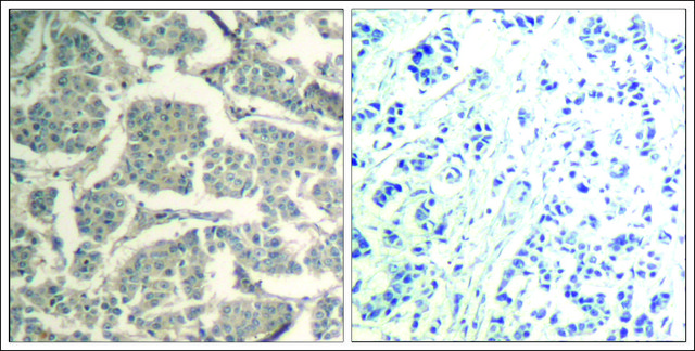 Anti-CCFL1/CFL2 (Ab-88) antibody produced in
