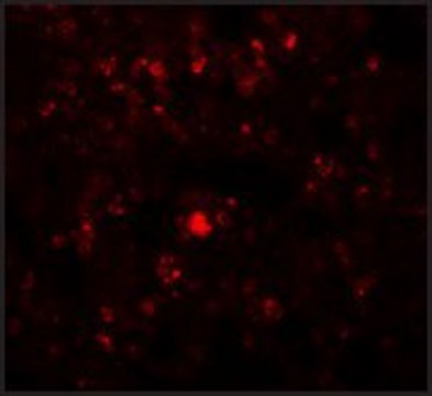 Anti-RHBDD2 antibody produced in rabbit