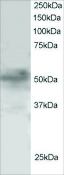 Anti-FOXQ1/FKHRL1 antibody produced in goat
