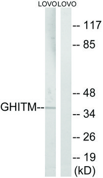 Anti-GHITM antibody produced in rabbit