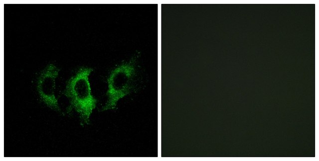 Anti-GFM2 antibody produced in rabbit