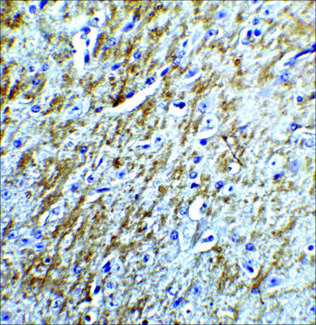 Anti-Survivin antibody produced in rabbit