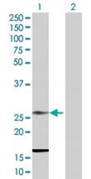 Anti-RNF141 antibody produced in rabbit