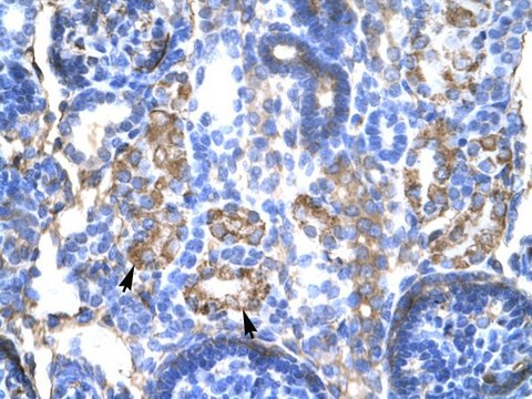 Anti-SERPINA1 (C-terminal) antibody produced in