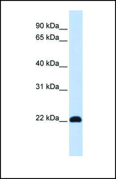 Anti-KLF16, (N-terminal) antibody produced in