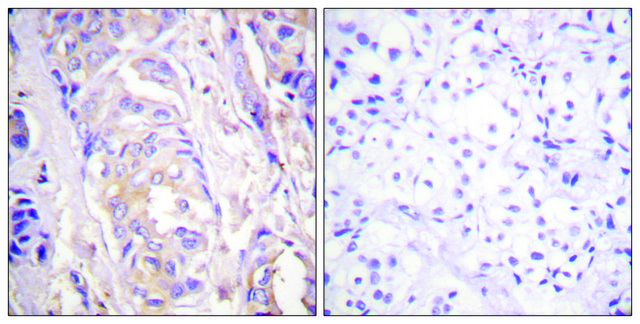 Anti-MEK1 antibody produced in rabbit