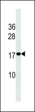 ANTI-ADM2 (N-TERM) antibody produced in