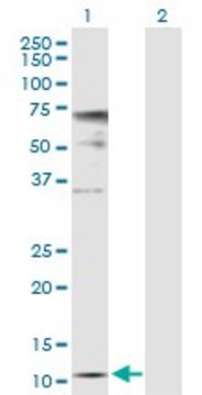 Anti-ZNRD1 antibody produced in rabbit