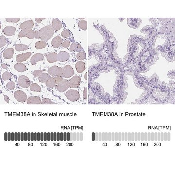 Anti-TMEM38A antibody produced in rabbit