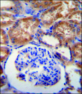 ANTI-TMEM14B (CENTER) antibody produced in