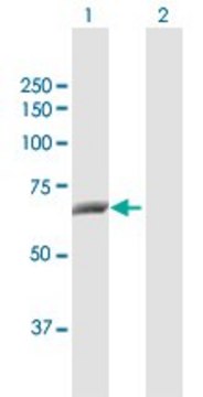 Anti-CTPS2 antibody produced in rabbit