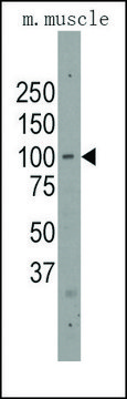 Anti-PARP12 (C-term) antibody produced in