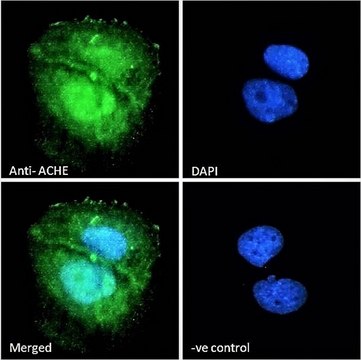 Anti-ACHE antibody produced in goat
