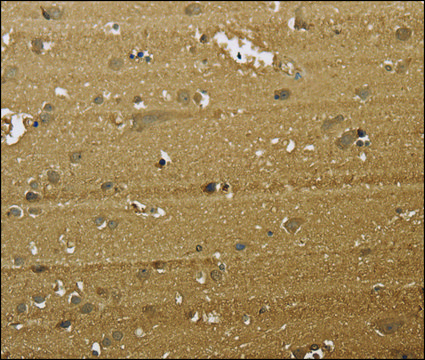 Anti-KDM5B antibody produced in rabbit