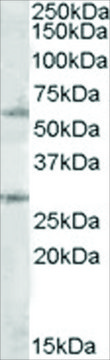 Anti-SOCS7 antibody produced in goat