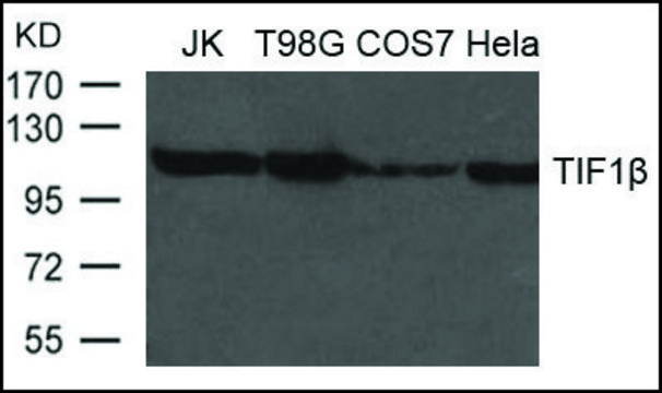 Anti-TIF1? antibody produced in rabbit