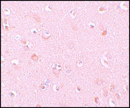Anti-NALP5 antibody produced in rabbit