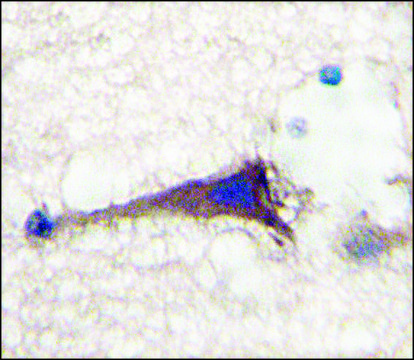 Anti-APPBP1 (N-term) antibody produced in