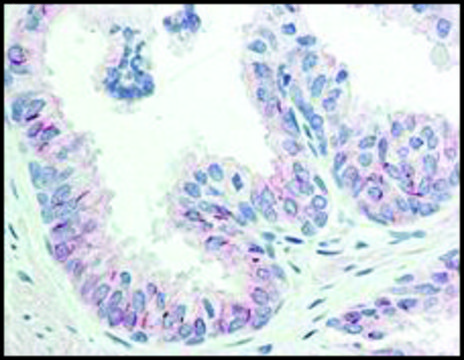 Monoclonal Anti-AKT pS473 antibody produced