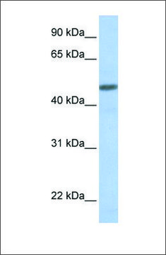 Anti-CALCRL antibody produced in rabbit