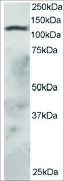 Anti-RNF31/ZIBRA, C-Terminal antibody produced in