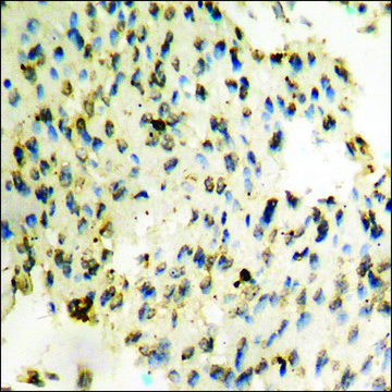 Anti-phospho-PYK2 (pTyr???) antibody produced in