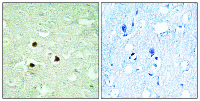 Anti-RAB3IP antibody produced in rabbit