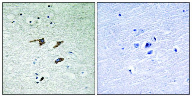 Anti-FAK antibody produced in rabbit