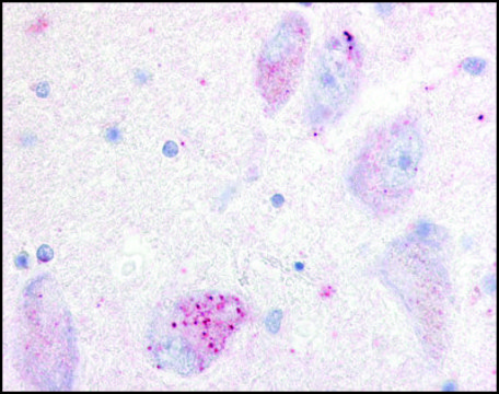 Anti-GPR20 (AB2) antibody produced in