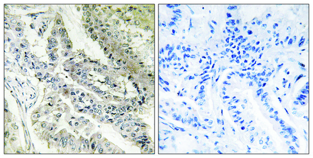 Anti-CRBP III antibody produced in