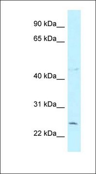 Anti-CCDC85B antibody produced in rabbit