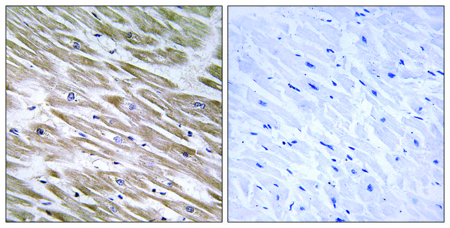 Anti-KANK2 antibody produced in rabbit