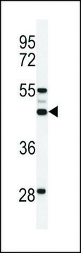 ANTI-OST ALPHA(C-TERMINAL) antibody produced in