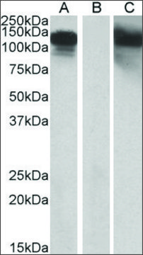 Anti-CDH11 antibody produced in goat