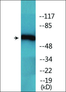 Anti-phospho-Chk2 (pThr??) antibody produced in