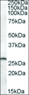 Anti-PSPH (C-terminal) antibody produced in