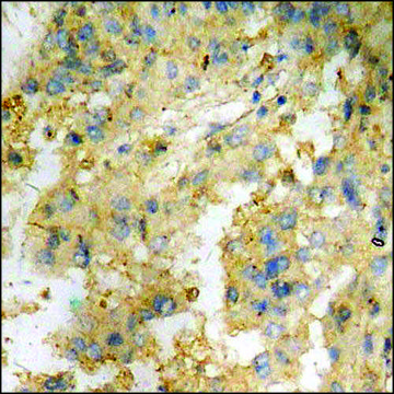 Anti-phospho-Stathmin 1 (pSer¹?) antibody produced
