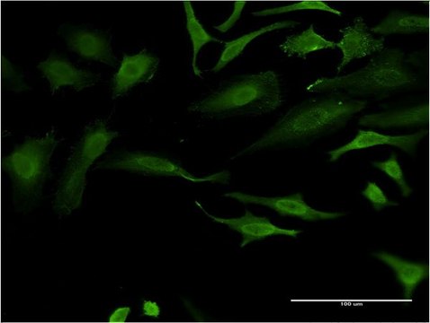 ANTI-FOXO1A antibody produced in mouse
