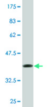Monoclonal Anti-C11ORF17, (C-terminal) antibody produced
